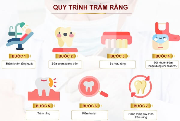 Quy trình trám răng tại Nha khoa City Smiles