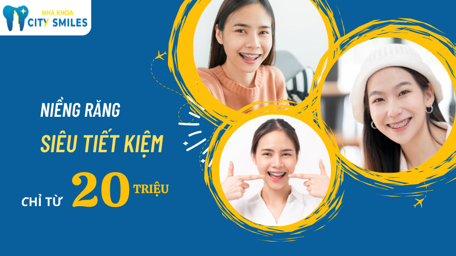 niềng răng 20 triệu