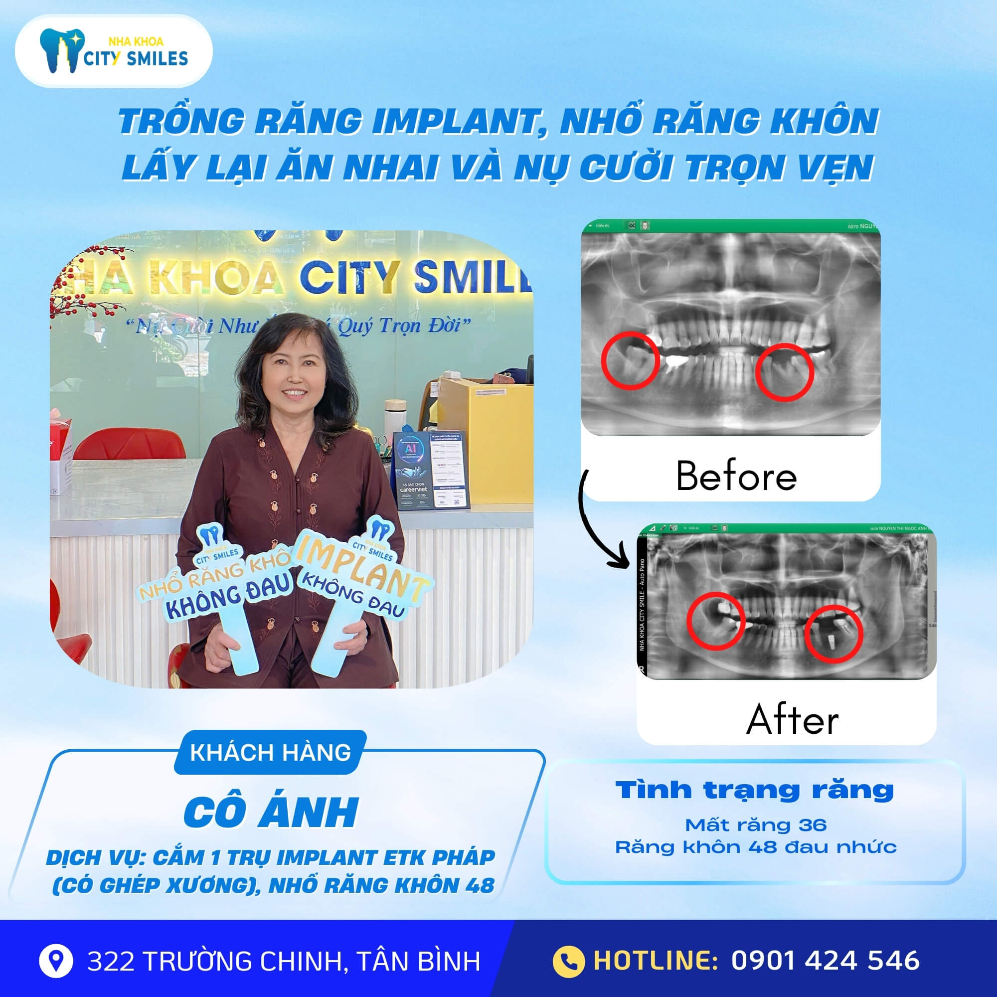 Cô Nguyễn Thị Ngọc Ánh – 63 tuổi