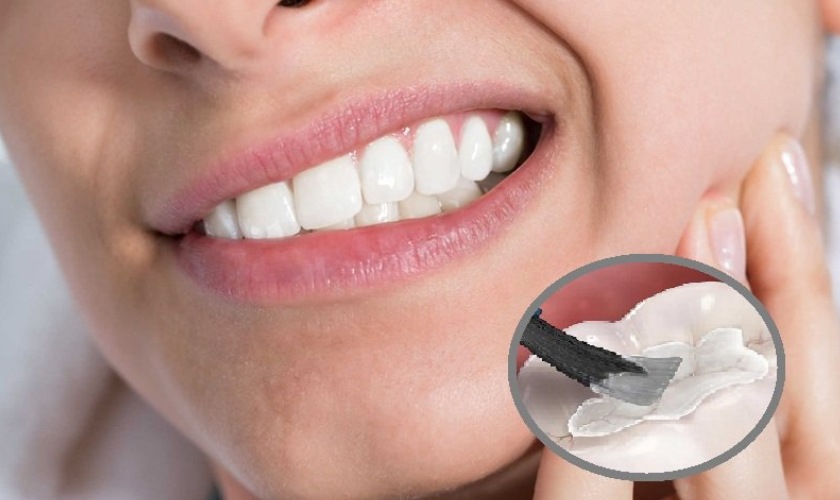 Tác Hại Của Việc Trám Răng Là Gì? 10 Biến Chứng Có Thể Gặp Và Cách Phòng Tránh 4 Trám răng có thể gây ê buốt nếu vật liệu không tốt & sai kỹ thuật