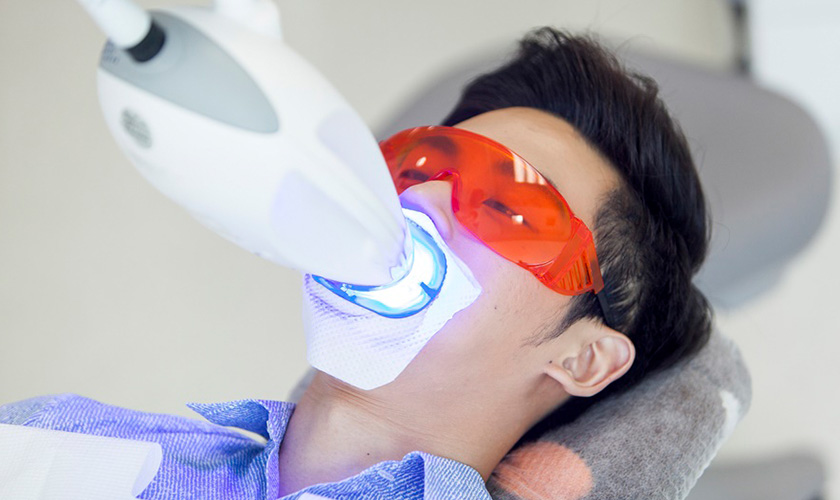 Có nên tẩy trắng răng tại nha khoa? So sánh với tẩy trắng răng tại nhà dưới góc nhìn chuyên môn 3