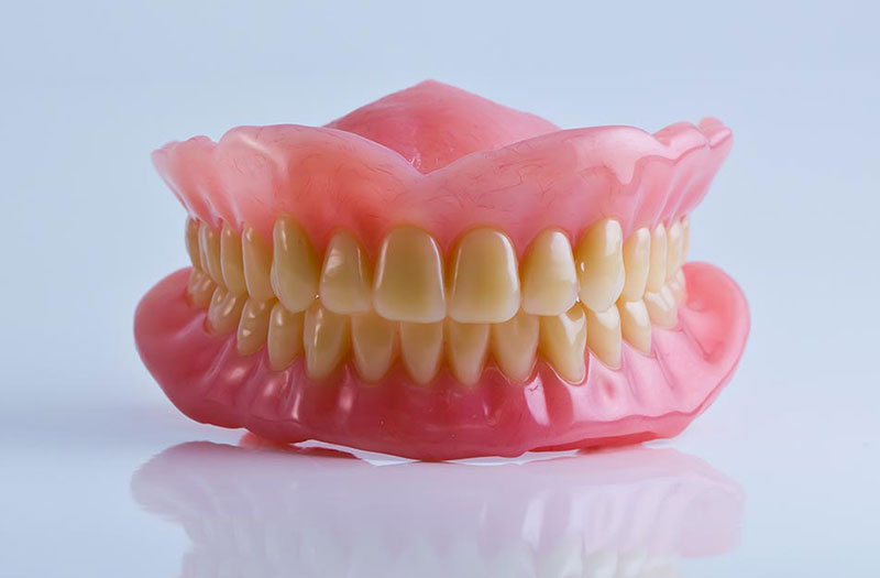 Implant toàn hàm là gì? Đối tượng, quy trình và chi phí 3 Hàm giả tháo lắp gặp nhiều bất cập trong sinh hoạt