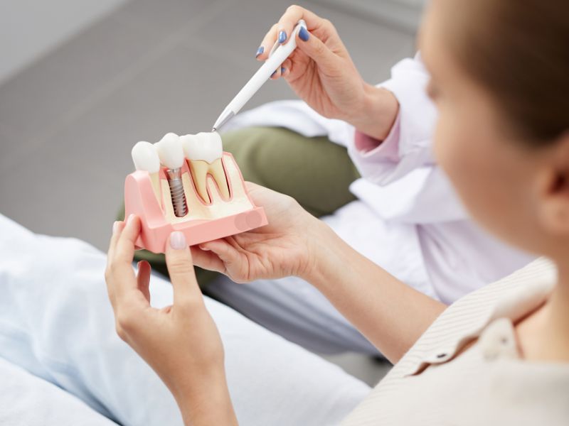 Mất răng có nên trồng Implant không? Không phải nha khoa nào cũng nói cho bạn điều này 6 Sau khi trồng răng Implant cần được chăm sóc đúng cách