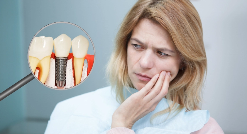 Trồng răng Implant có đau không? Mức độ đau và cách giảm đau 3 Trồng răng Implant có đau không? Mức độ đau và cách giảm đau 2