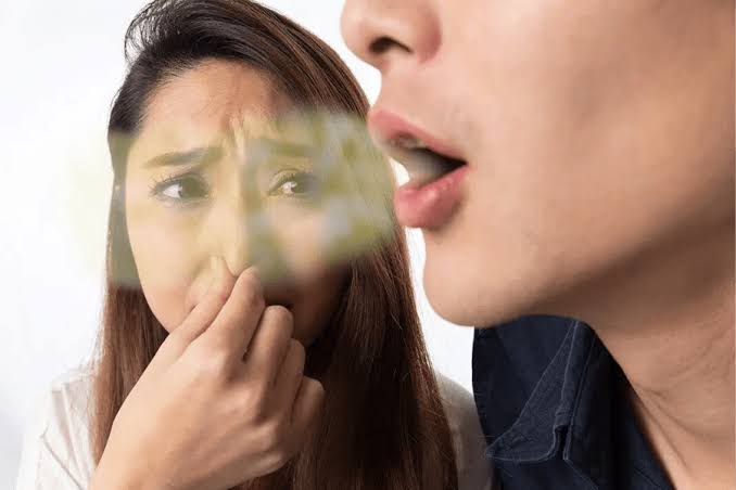 Dấu hiệu viêm nha chu: Chảy máu chân răng, tụt lợi, hôi miệng 3 Tình trạng hôi miệng kéo dài